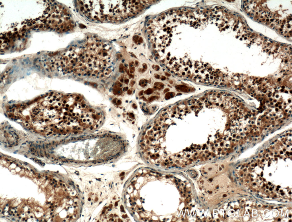 IHC staining of human testis using 22329-1-AP