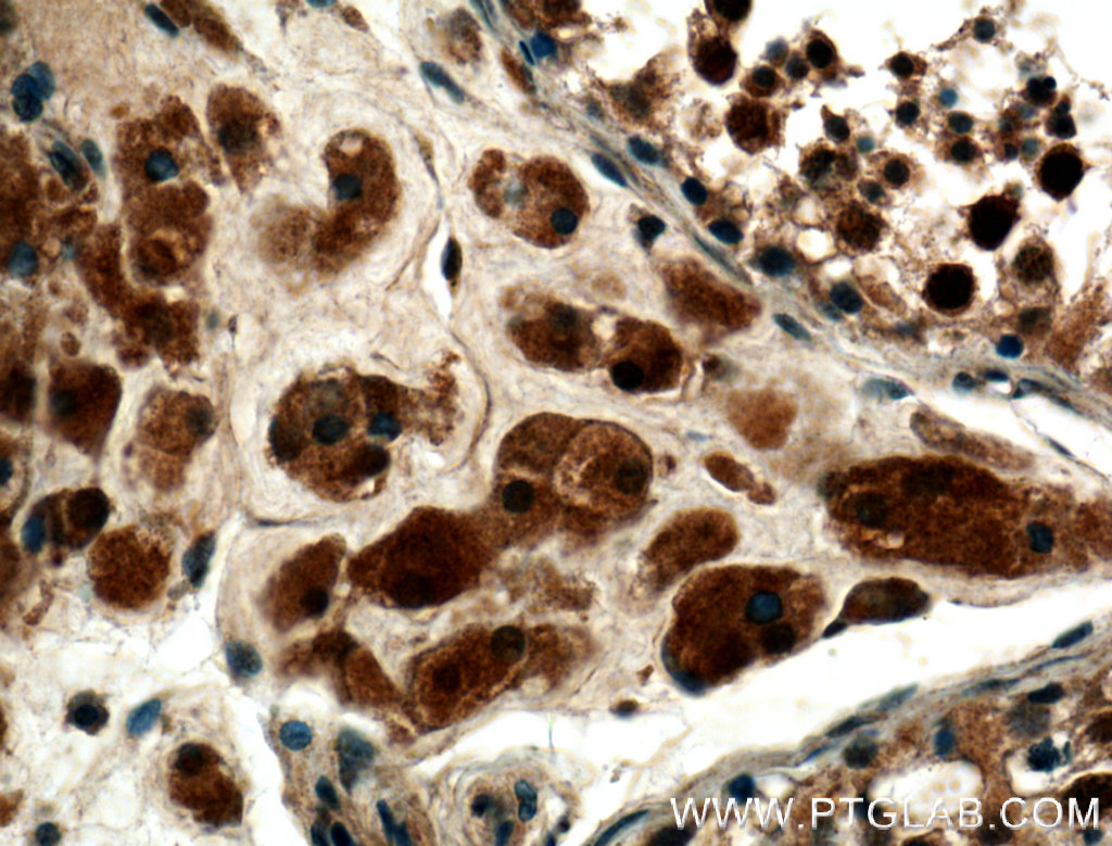 IHC staining of human testis using 22329-1-AP