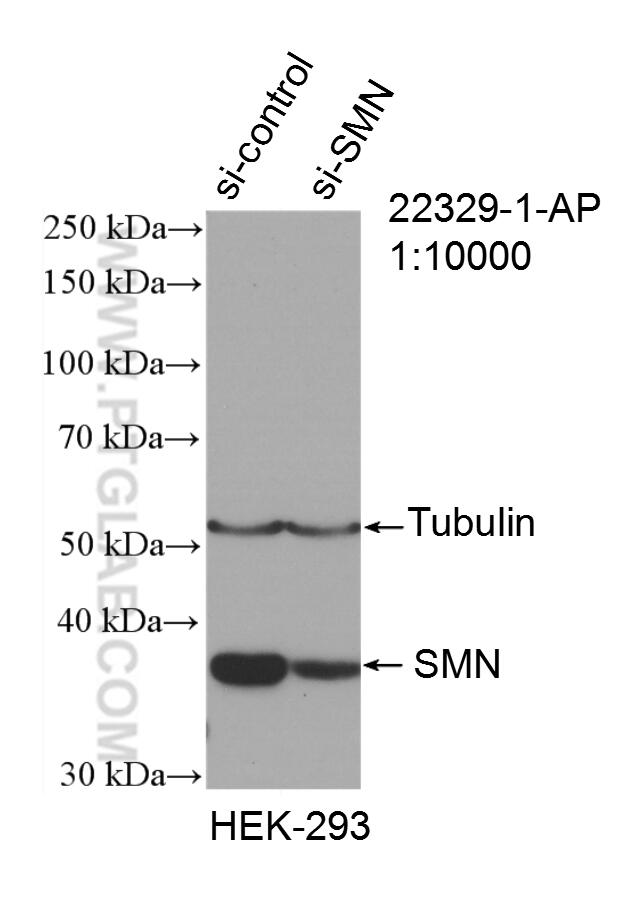 WB analysis of HEK-293 using 22329-1-AP