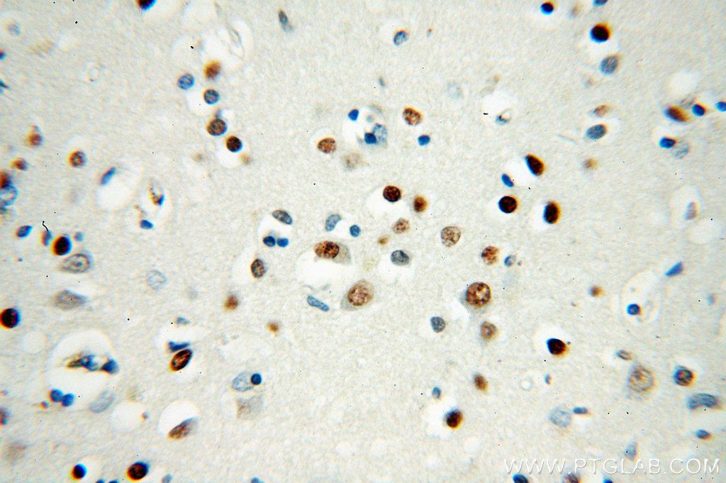 IHC staining of human brain using 60154-1-Ig