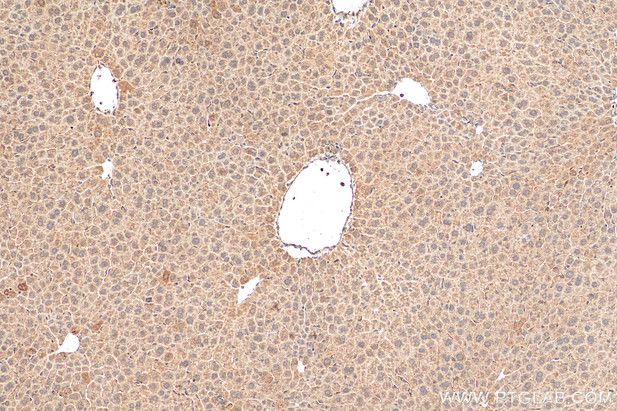 IHC staining of mouse liver using 60154-2-Ig
