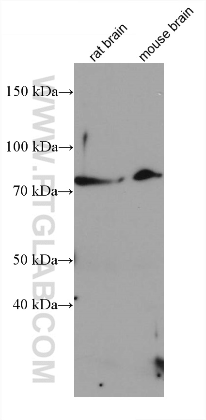 WB analysis using 66851-1-Ig