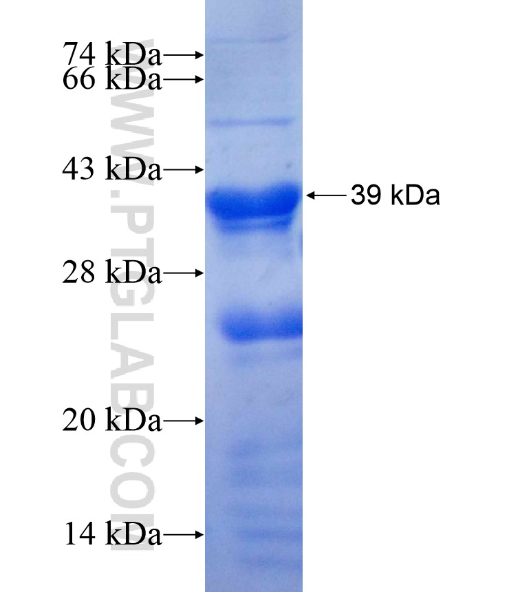 SMO fusion protein Ag16993 SDS-PAGE SMO fusion protein Ag16993 SDS-PAGE