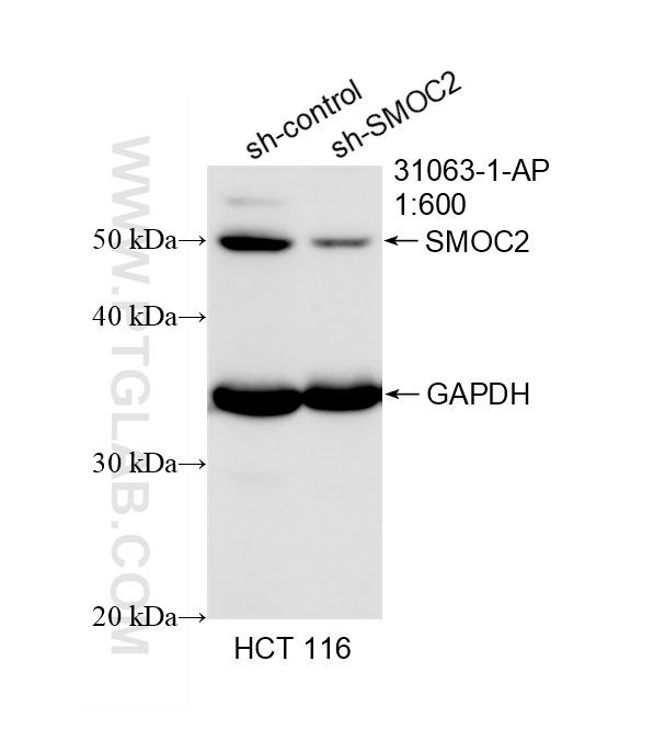 WB result of SMOC2 antibody (31063-1-AP; 1:600; incubated at room temperature for 1.5 hours) with sh-Control and sh-SMOC2 transfected HCT 116 cells. WB analysis of HCT 116 using 31063-1-AP