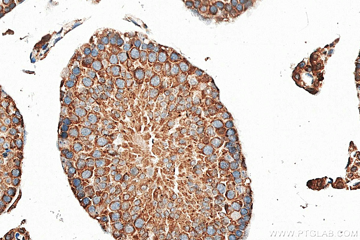 IHC staining of mouse testis using 15052-1-AP IHC staining of mouse testis using 15052-1-AP
