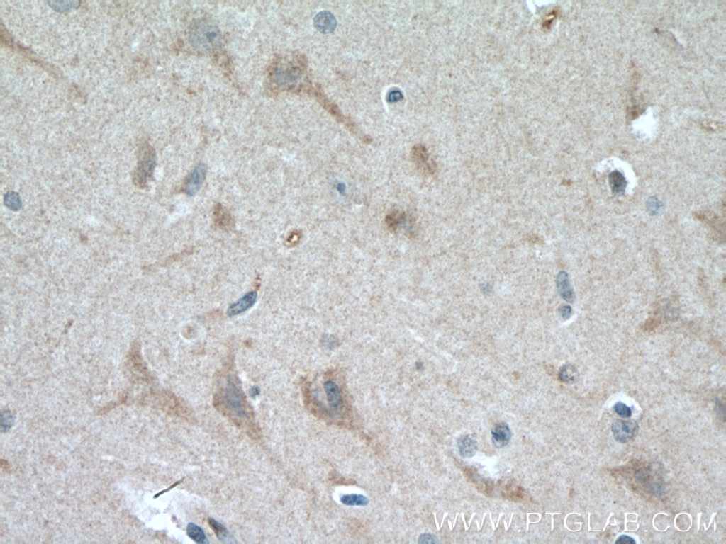 IHC staining of human brain using 14609-1-AP