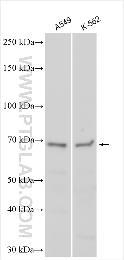 WB analysis using 25613-1-AP