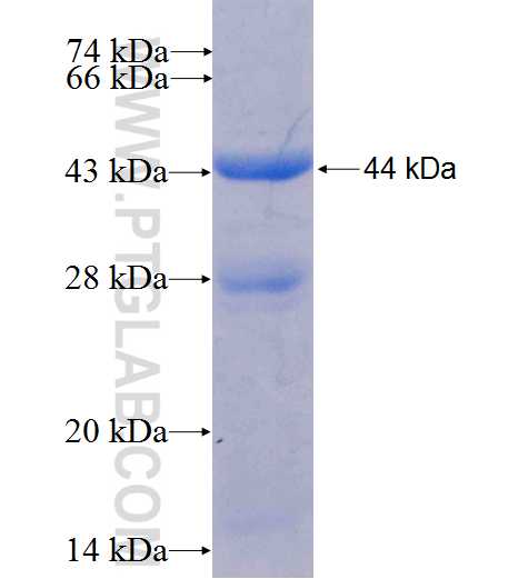 SMPDL3A fusion protein Ag9382 SDS-PAGE SMPDL3A fusion protein Ag9382 SDS-PAGE