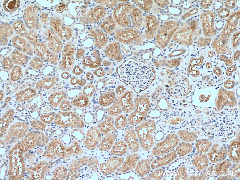 IHC staining of human kidney using 16552-1-AP