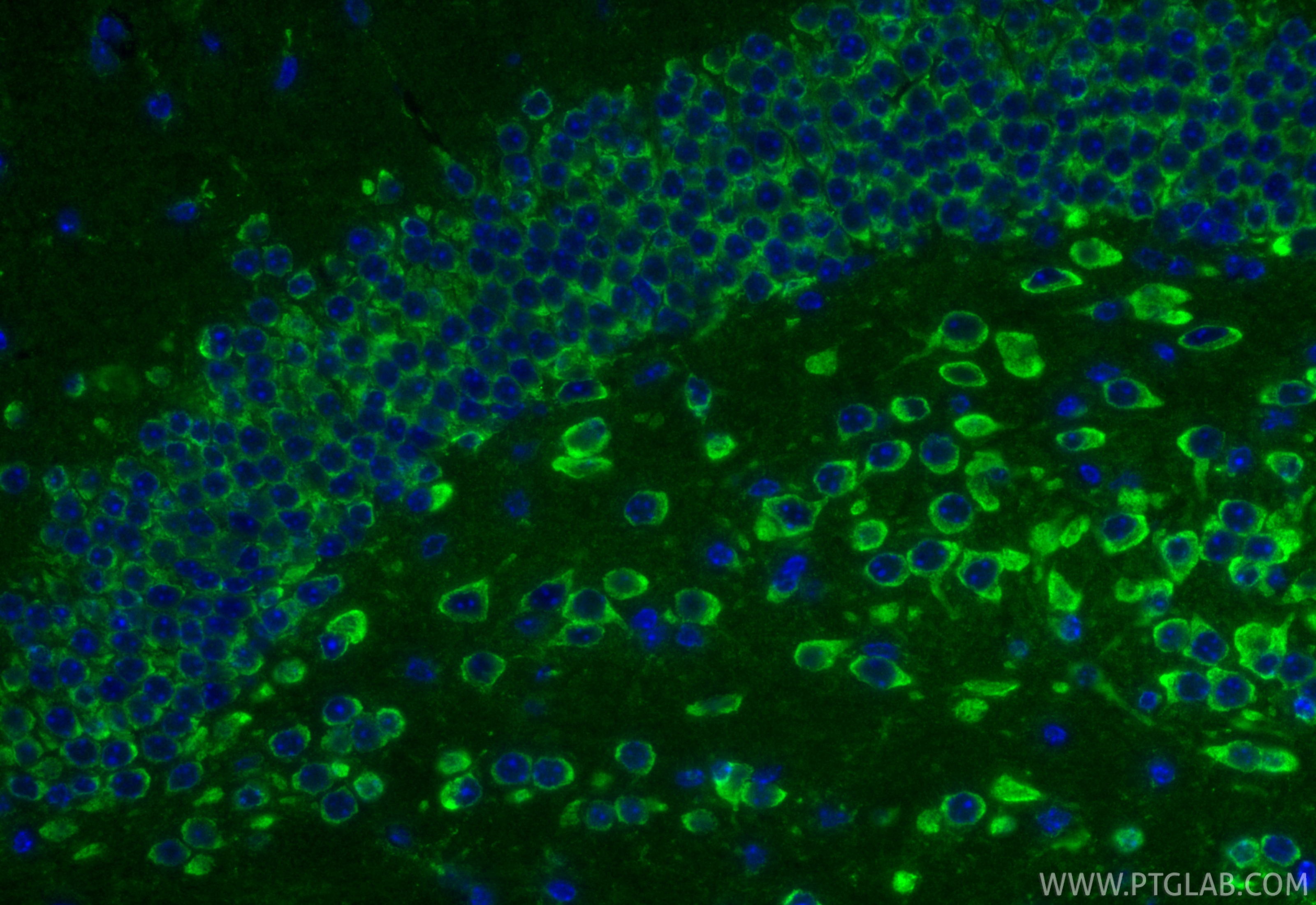 IF Staining of mouse brain using 15791-1-AP IF Staining of mouse brain using 15791-1-AP