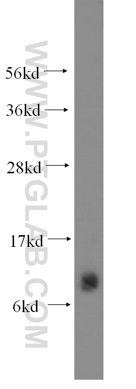 WB analysis of human skeletal muscle using 15791-1-AP