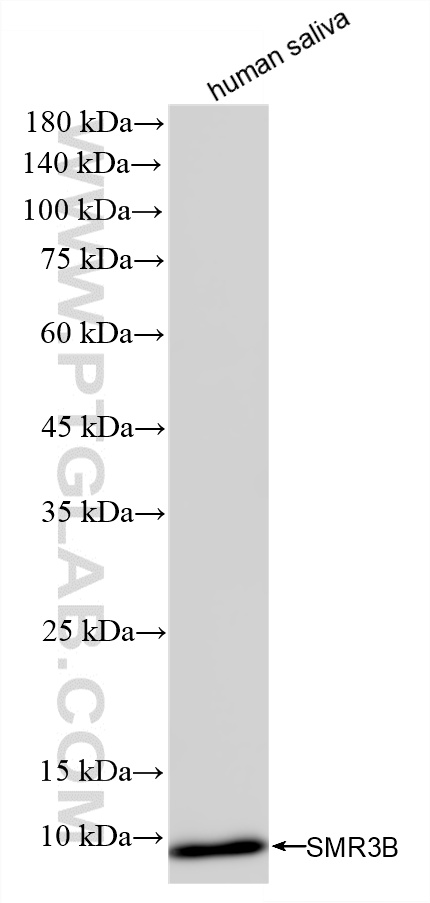 WB analysis of human saliva using 85745-3-RR