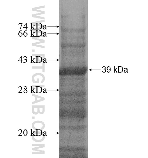 SMTN fusion protein Ag14610 SDS-PAGE SMTN fusion protein Ag14610 SDS-PAGE