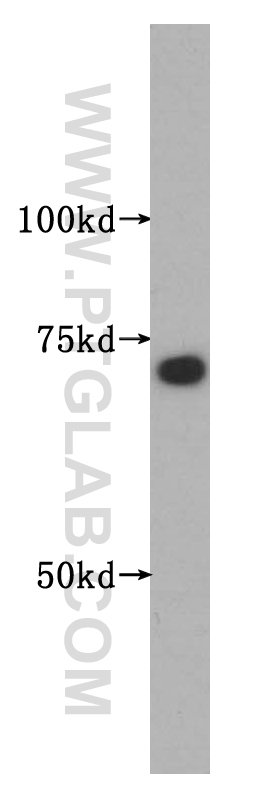 WB analysis of COLO 320 using 14782-1-AP