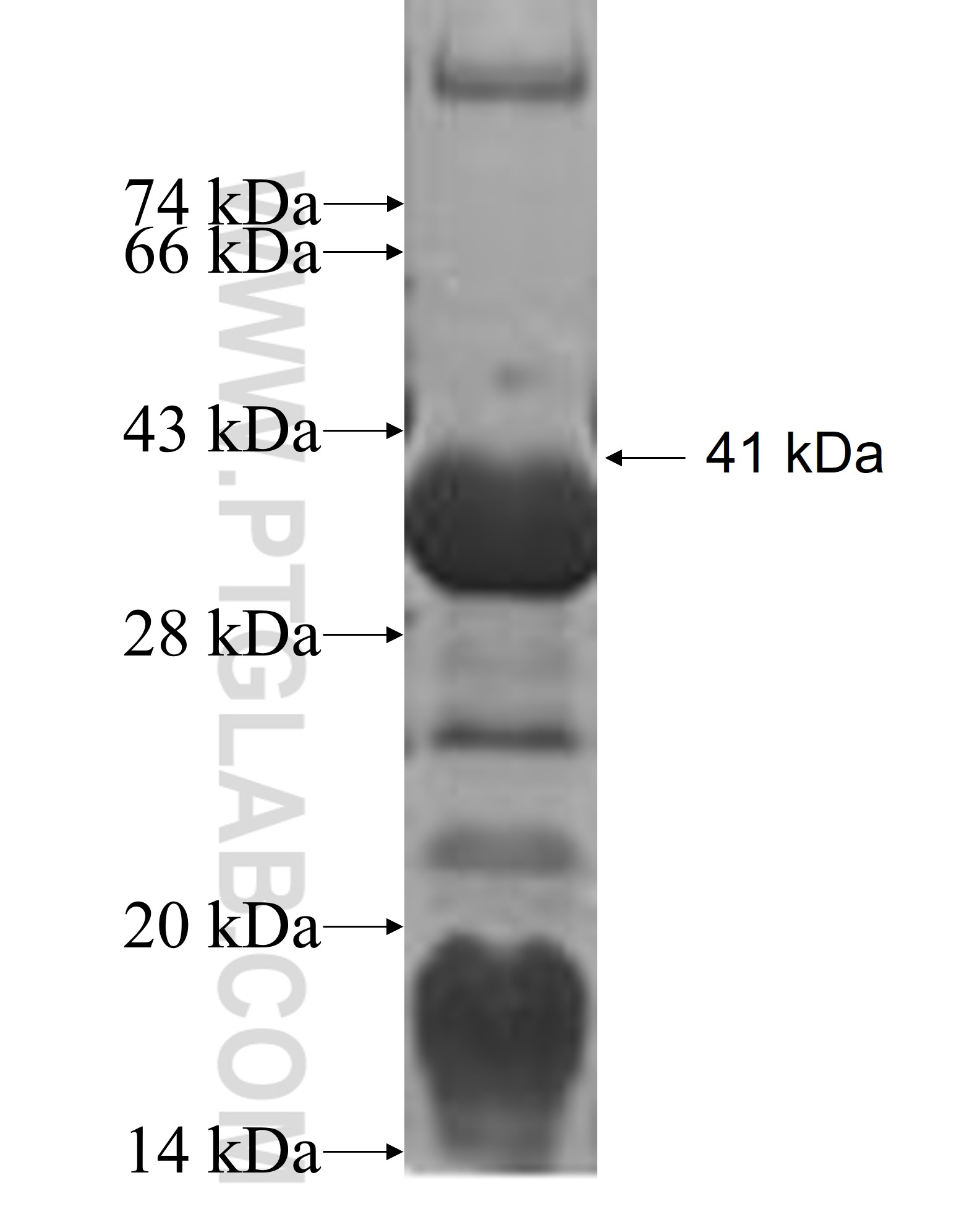 SMTNL2 fusion protein Ag6395 SDS-PAGE