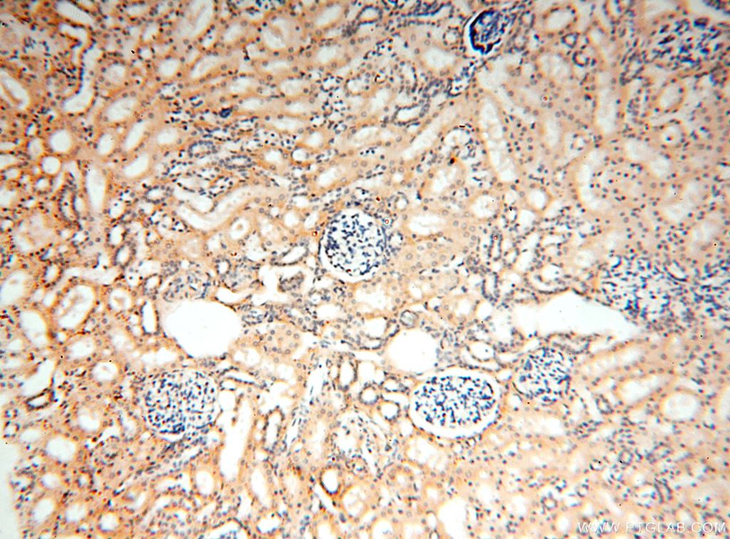 IHC staining of human kidney using 15511-1-AP