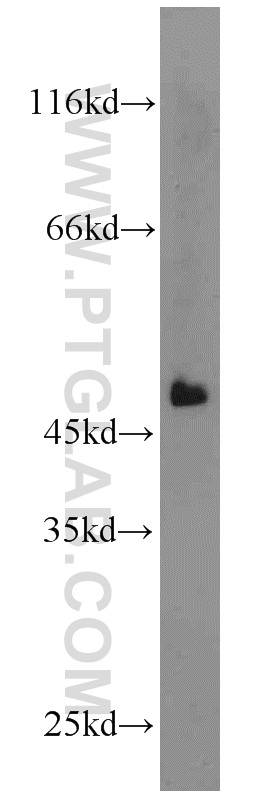 WB analysis of mouse liver using 15511-1-AP