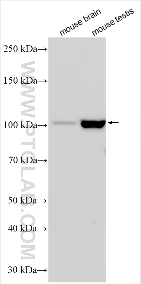 WB analysis using 55175-1-AP