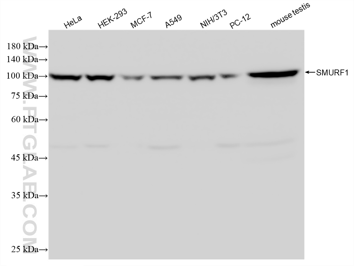 WB analysis using 87769-1-RR WB analysis using 87769-1-RR