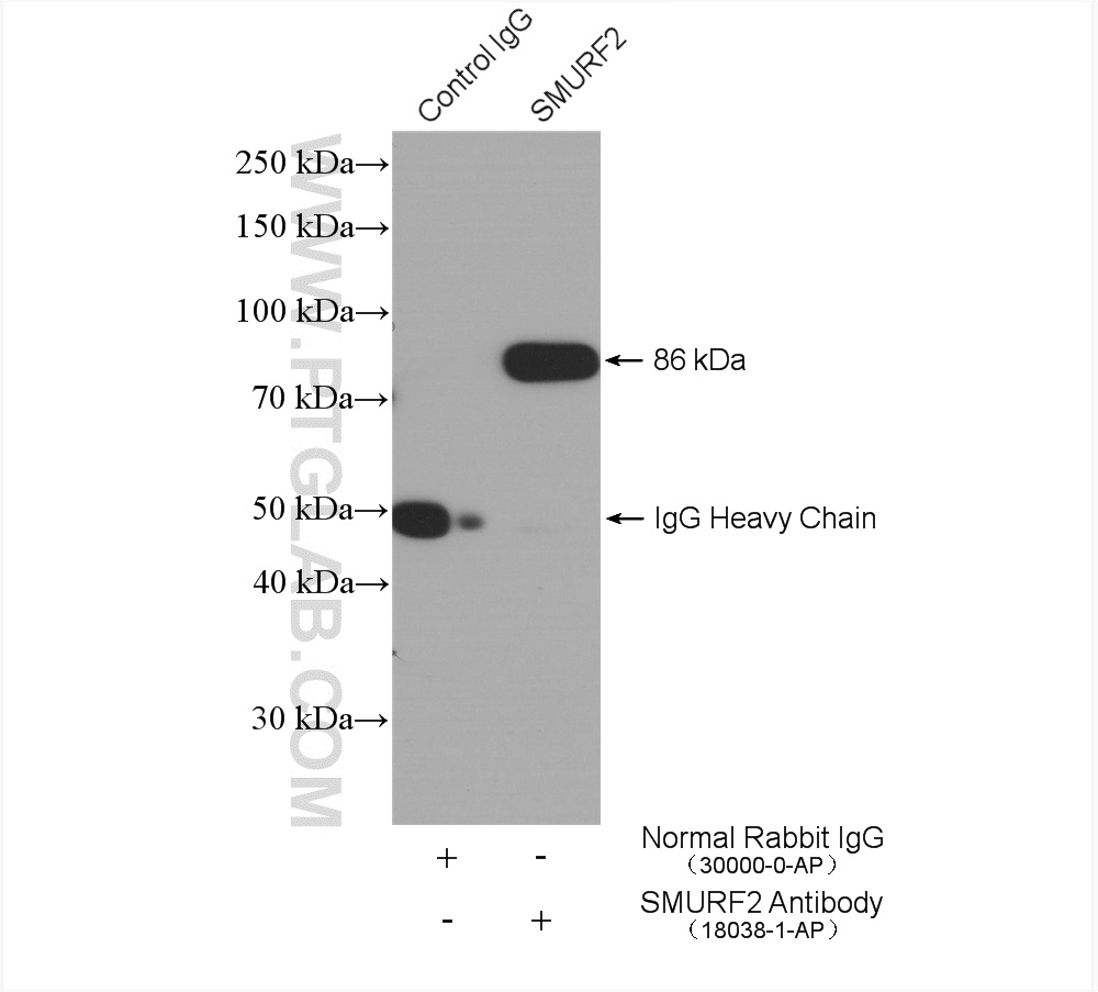 IP experiment of mouse testis using 18038-1-AP