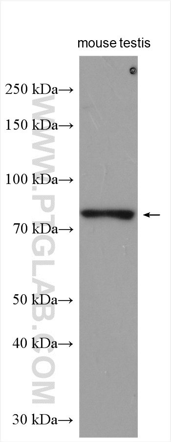 WB analysis using 18038-1-AP