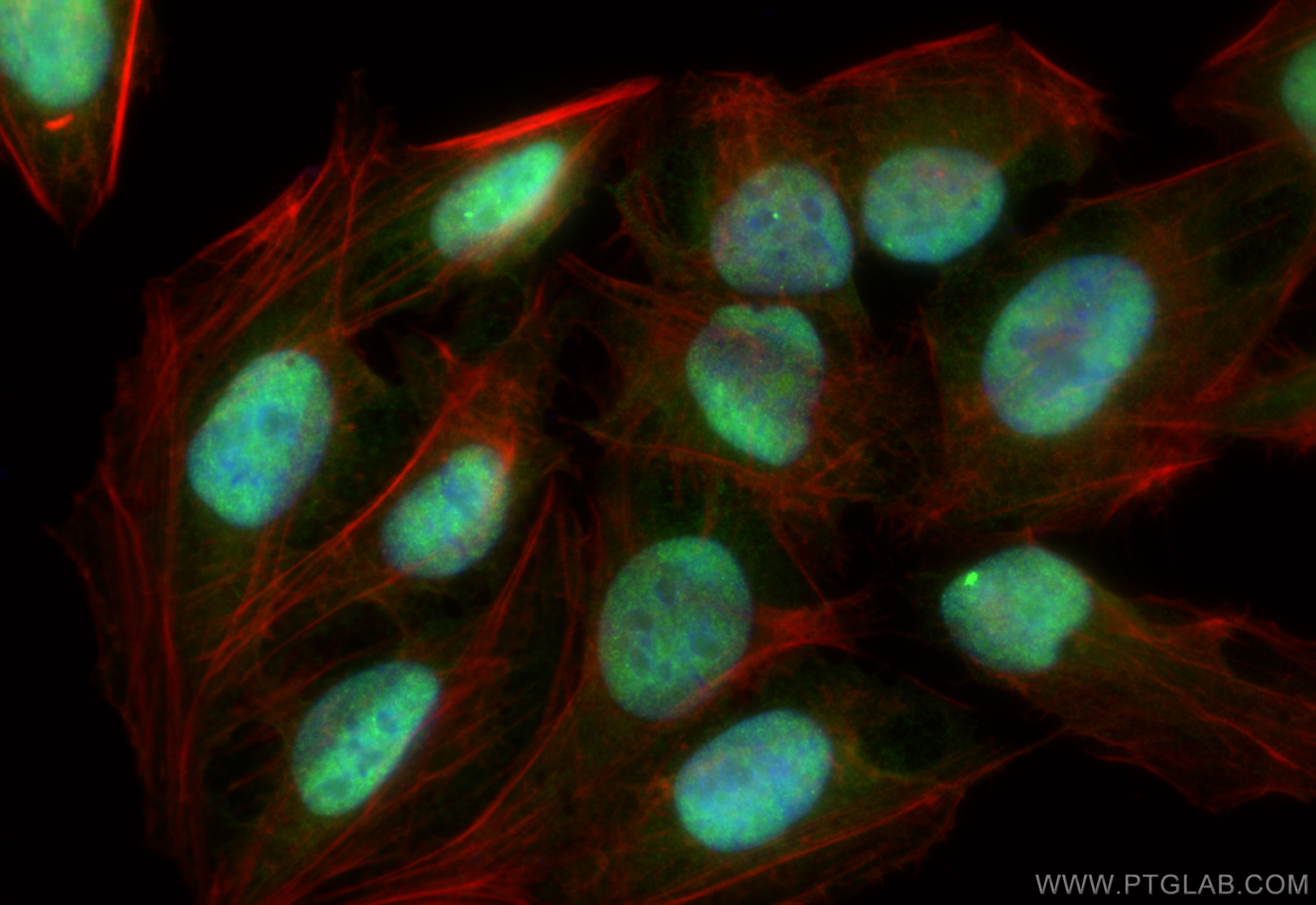 IF Staining of U2OS using 84445-1-RR (same clone as 84445-1-PBS)