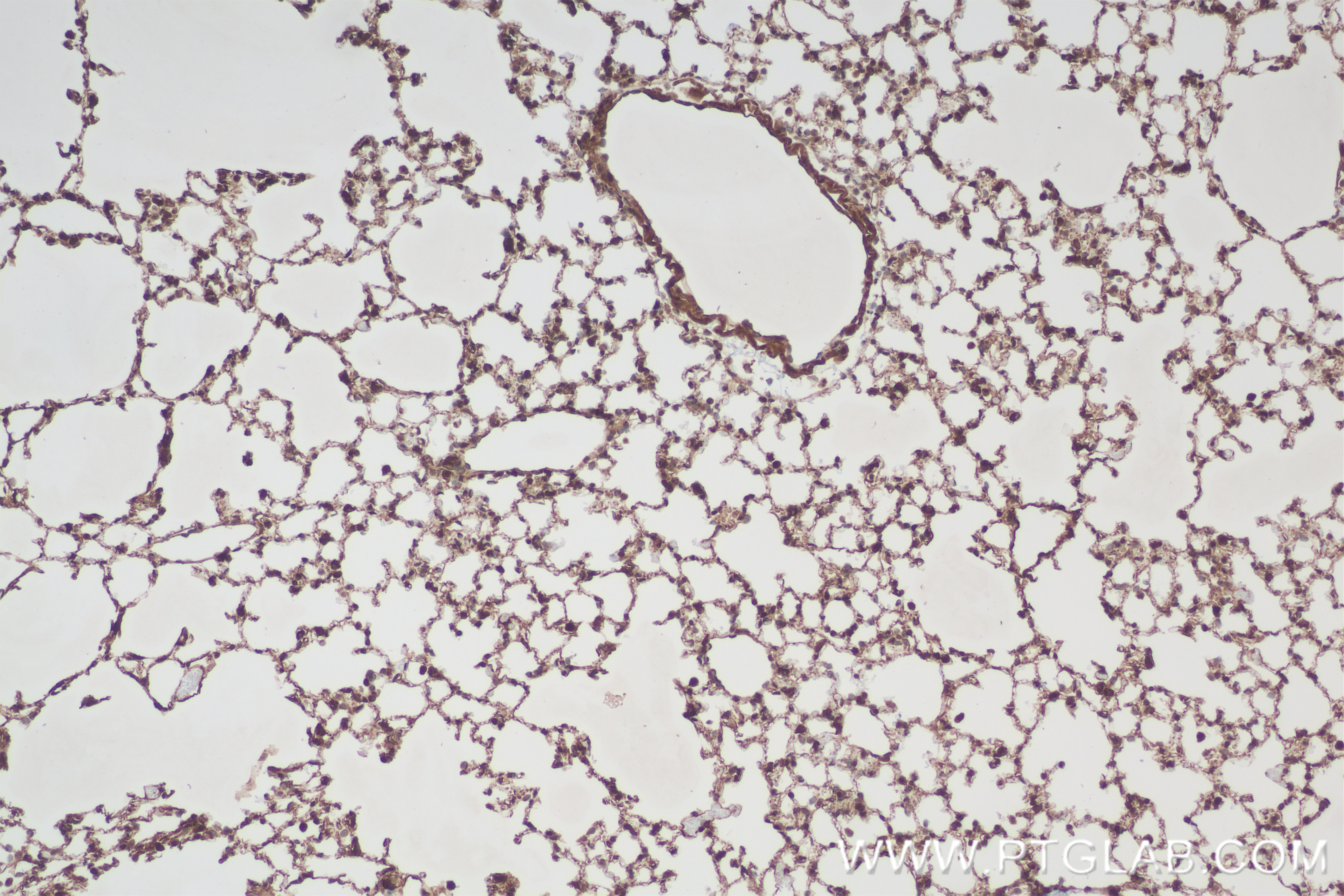 IHC staining of mouse lung using 84445-1-RR