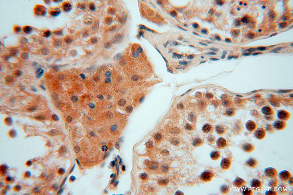 IHC staining of human testis using 16151-1-AP