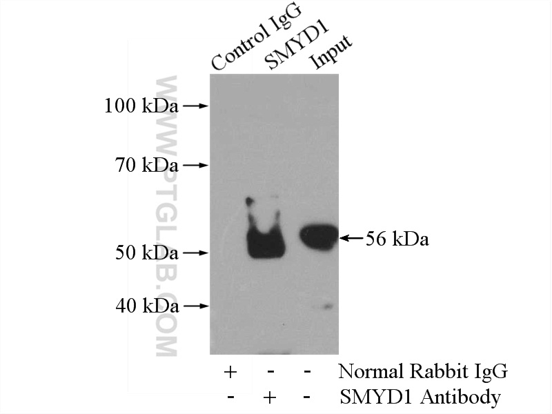 IP experiment of mouse heart using 16151-1-AP