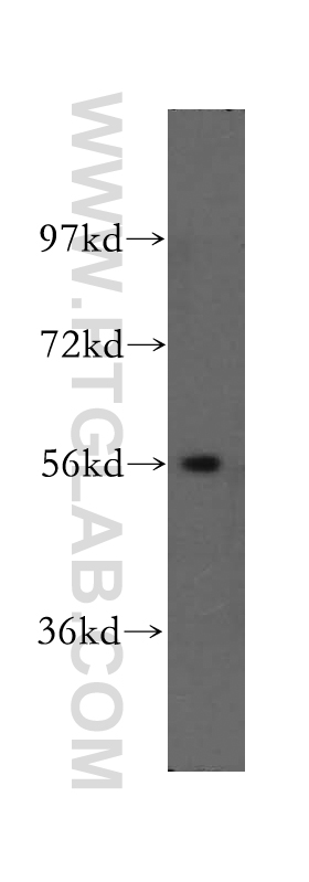 WB analysis of mouse heart using 16151-1-AP