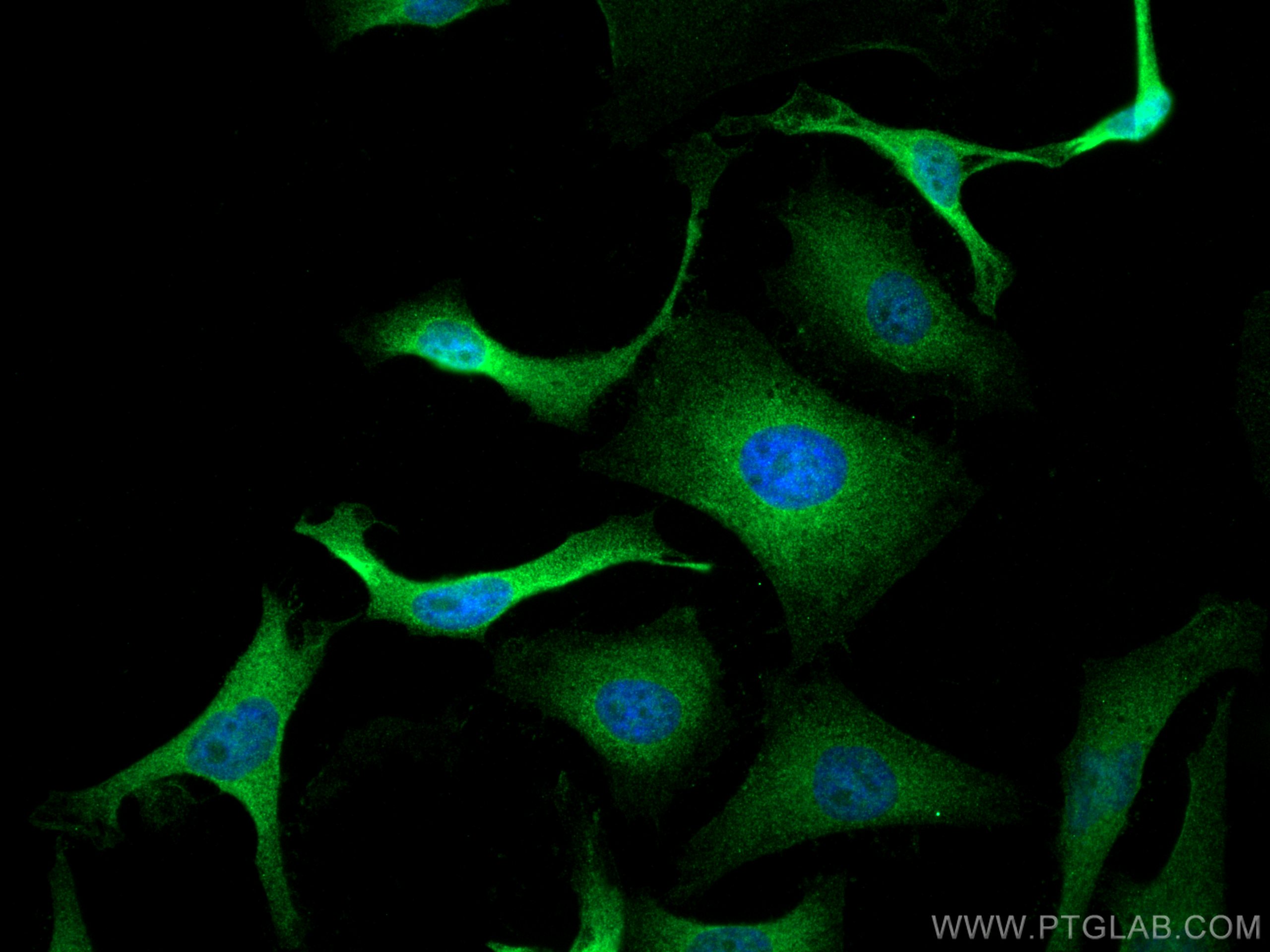 IF Staining of HeLa using 21290-1-AP