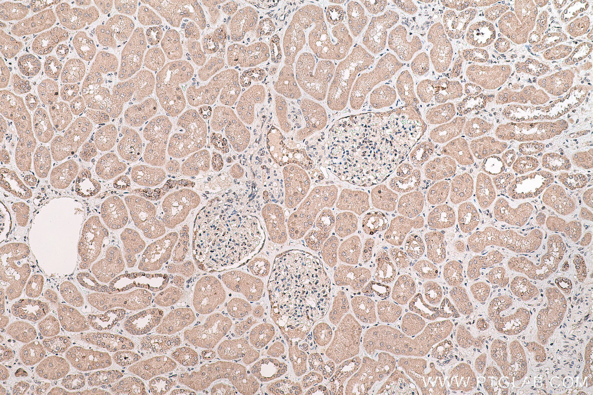 IHC staining of human kidney using 21290-1-AP IHC staining of human kidney using 21290-1-AP