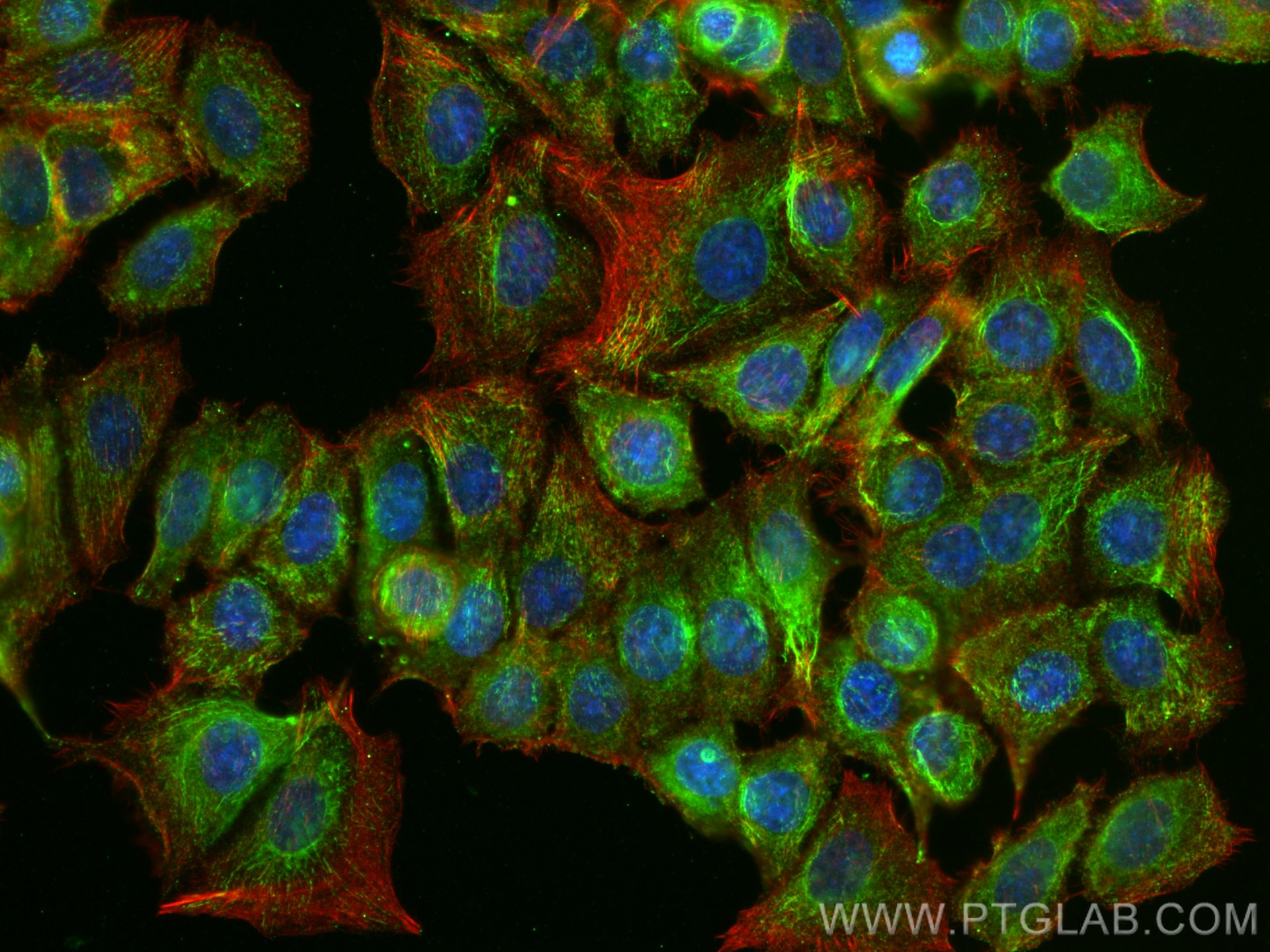 IF Staining of MCF-7 using 66330-1-Ig (same clone as 66330-1-PBS)