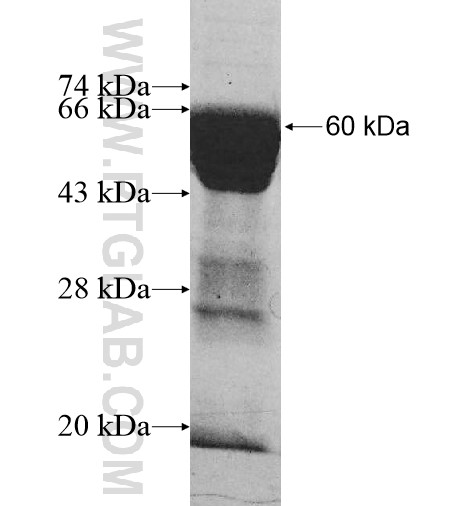 SMYD5 fusion protein Ag10337 SDS-PAGE