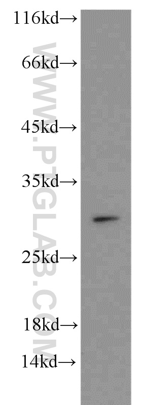 WB analysis of mouse heart using 13099-1-AP