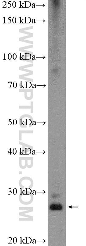 WB analysis of HeLa using 26183-1-AP