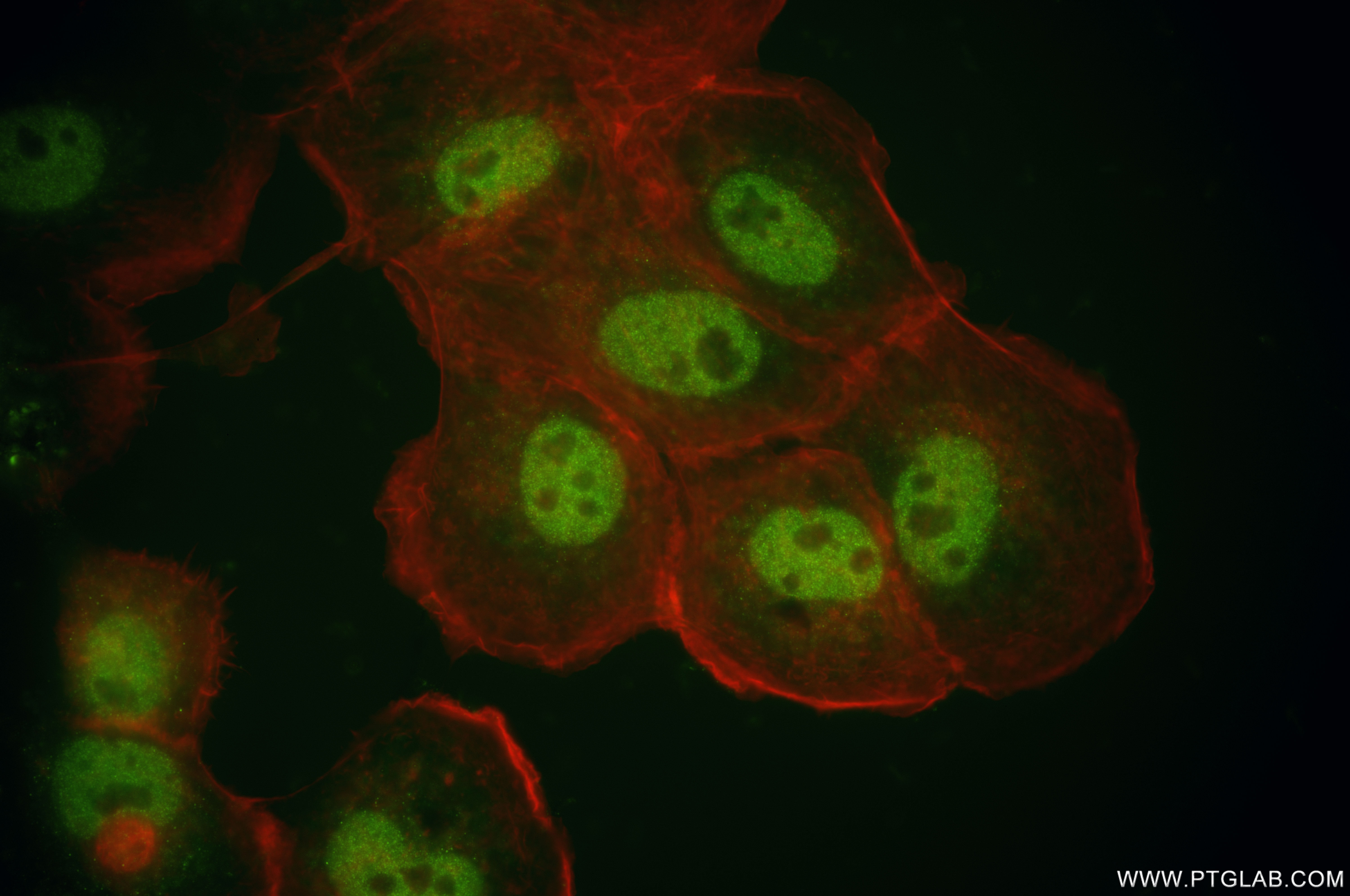 IF Staining of A431 using 82755-3-RR (same clone as 82755-3-PBS)