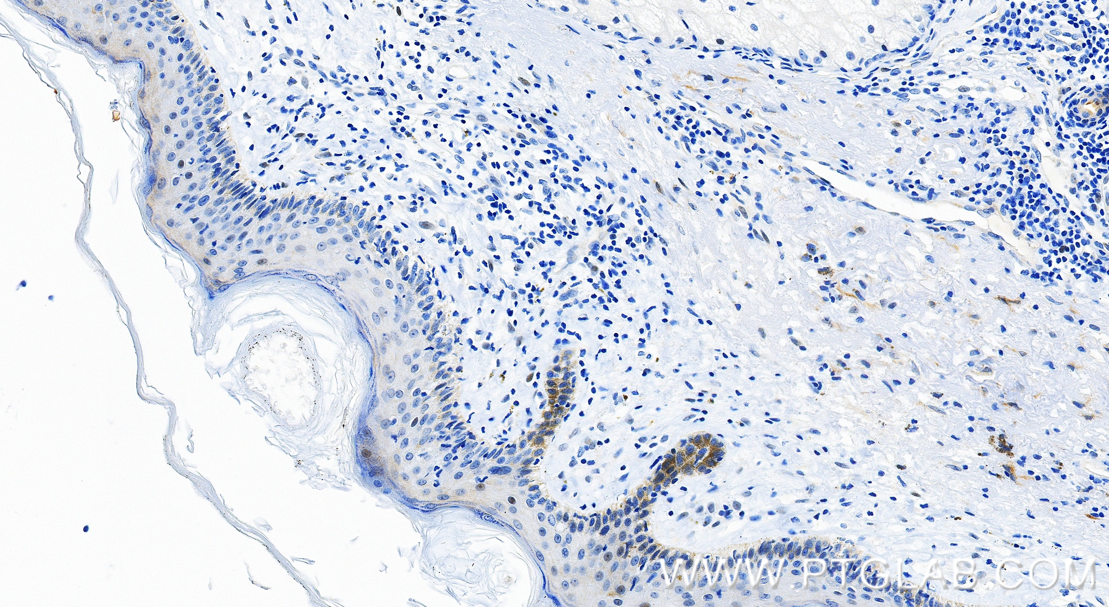 IHC staining of human skin using 82755-3-RR