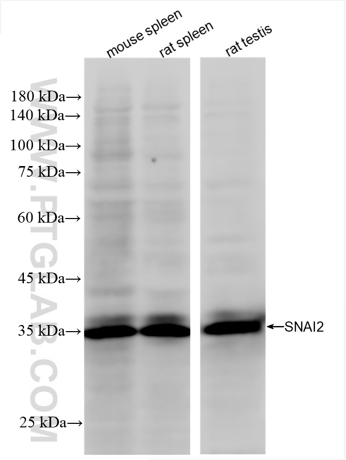 WB analysis using 82755-3-RR (same clone as 82755-3-PBS)