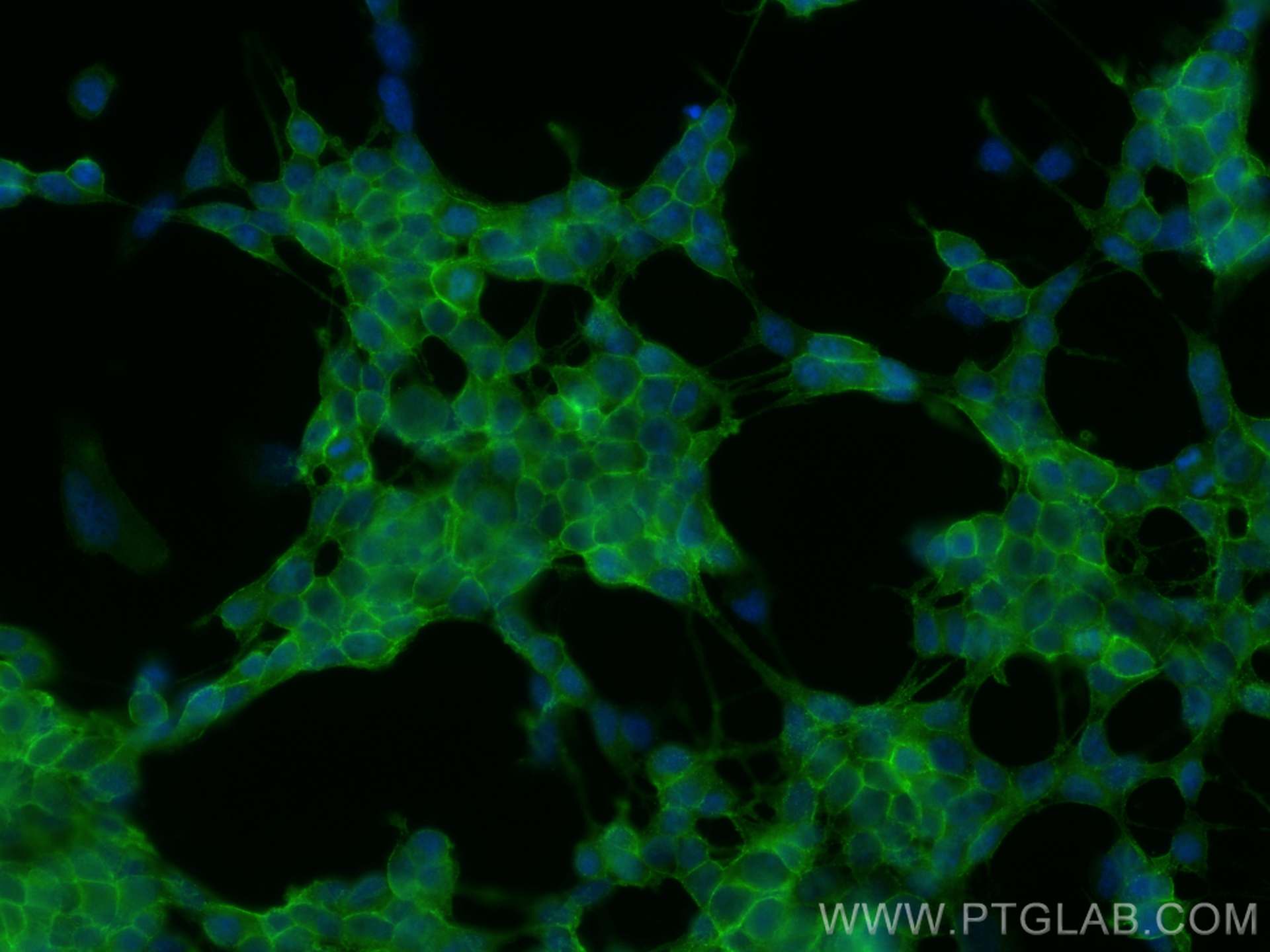 IF Staining of SH-SY5Y using 14903-1-AP