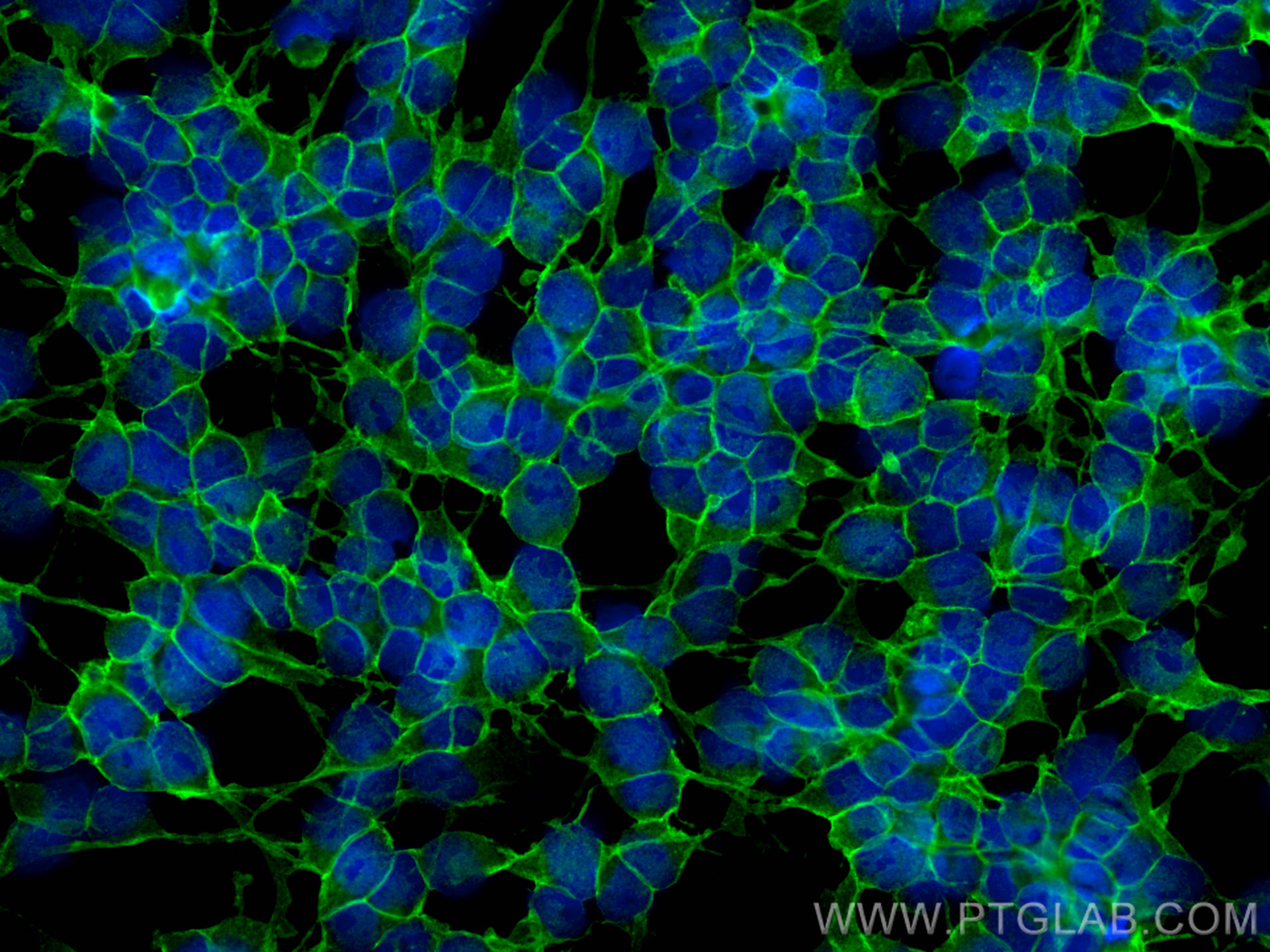 IF Staining of SH-SY5Y using 14903-1-AP