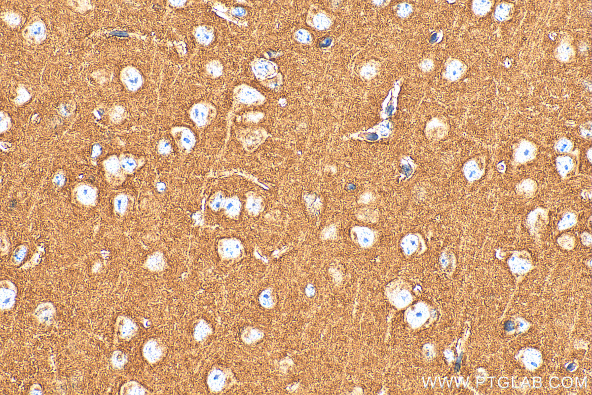 Immunohistochemical analysis of paraffin-embedded mouse brain tissue slide using <a class='green' href='/productredirect?CatalogNo=14903-1-AP' target='_blank'>14903-1-AP</a> (SNAP25 antibody) at dilution of 1:1000 (under 40x lens). Heat mediated antigen retrieval with Tris-EDTA buffer (pH 9.0). This data was developed using the same antibody clone with 14903-1-PBS in a different storage buffer formulation. IHC staining of mouse brain using 14903-1-AP (same clone as 14903-1-PBS)
