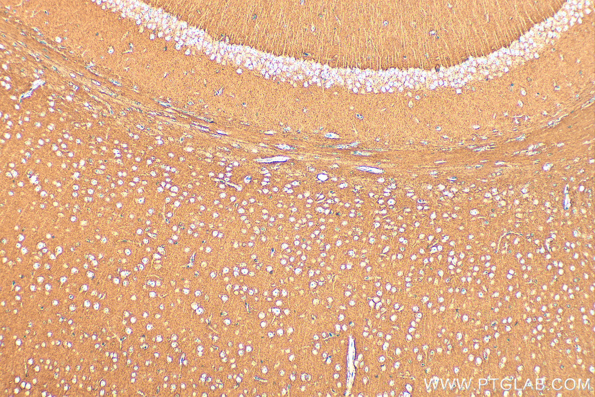 Immunohistochemical analysis of paraffin-embedded mouse brain tissue slide using <a class='green' href='/productredirect?CatalogNo=14903-1-AP' target='_blank'>14903-1-AP</a> (SNAP25 antibody) at dilution of 1:1000 (under 10x lens). Heat mediated antigen retrieval with Tris-EDTA buffer (pH 9.0). This data was developed using the same antibody clone with 14903-1-PBS in a different storage buffer formulation. IHC staining of mouse brain using 14903-1-AP (same clone as 14903-1-PBS)