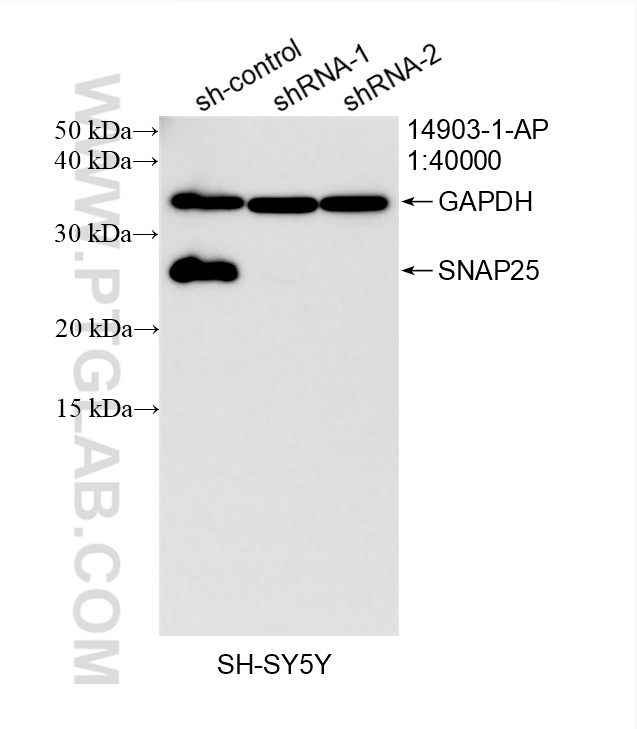 WB analysis of SH-SY5Y using 14903-1-AP WB analysis of SH-SY5Y using 14903-1-AP