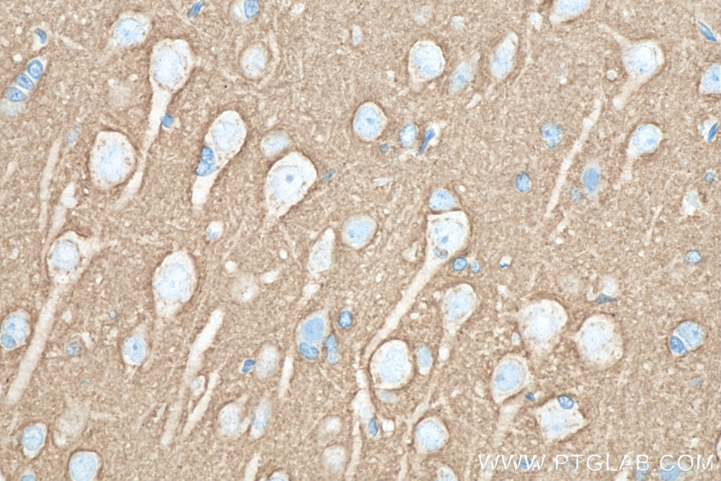 IHC staining of rat brain using 60159-1-Ig (same clone as 60159-1-PBS)