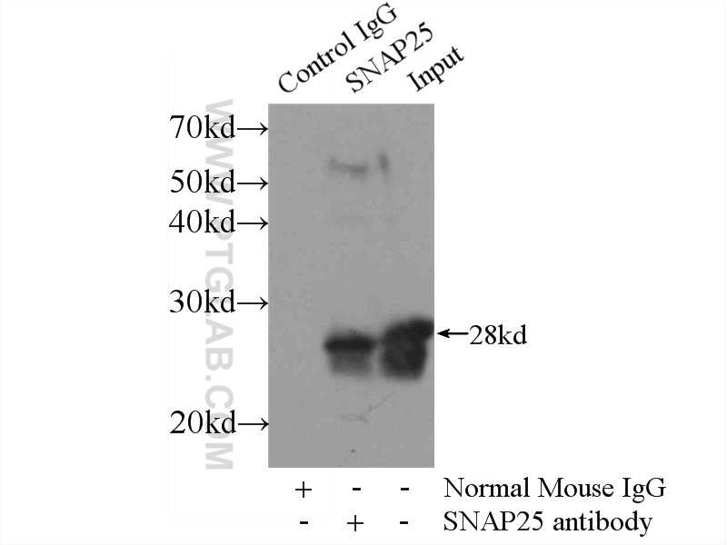 IP experiment of mouse brain using 60159-1-Ig