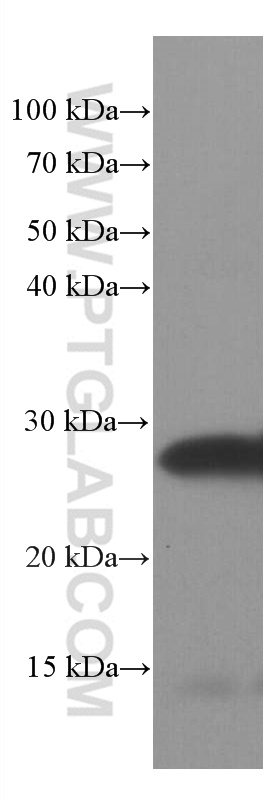 WB analysis of pig brain using 60159-1-Ig (same clone as 60159-1-PBS)