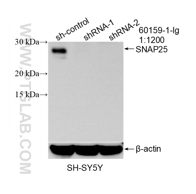 WB analysis of SH-SY5Y using 60159-1-Ig WB analysis of SH-SY5Y using 60159-1-Ig