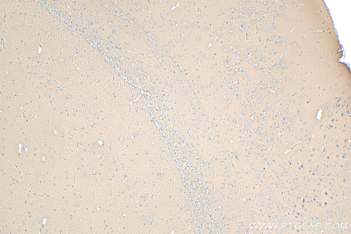 IHC staining of mouse brain using 83259-1-RR (same clone as 83259-1-PBS)