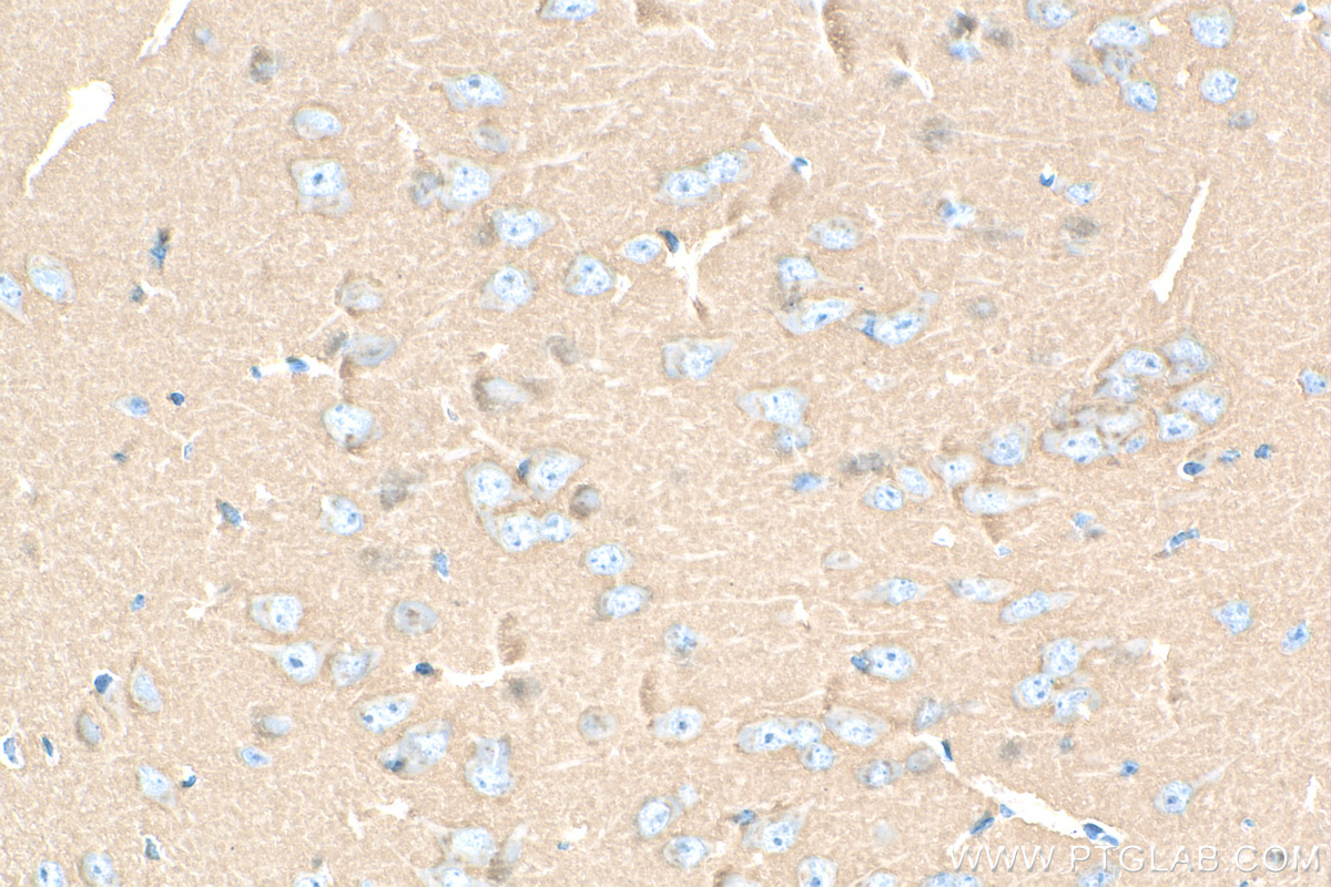 IHC staining of mouse brain using 83259-1-RR (same clone as 83259-1-PBS)